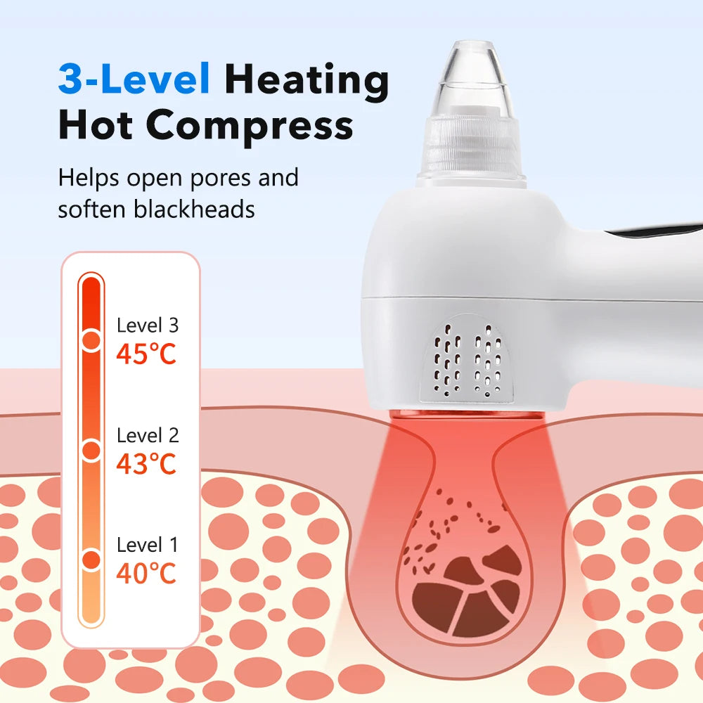 2-in-1 Smart Blackhead Remover Vacuum & Facial Pore Cleanser – Deep Pore Suction Device with 3-Level Heating Hot Compress