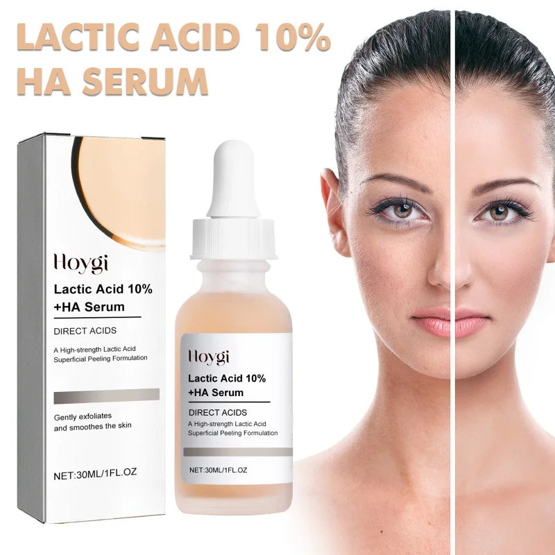 Hoygi Lactic Acid 10% + HA Serum – Exfoliating & Hydrating Face Peel (30ml)