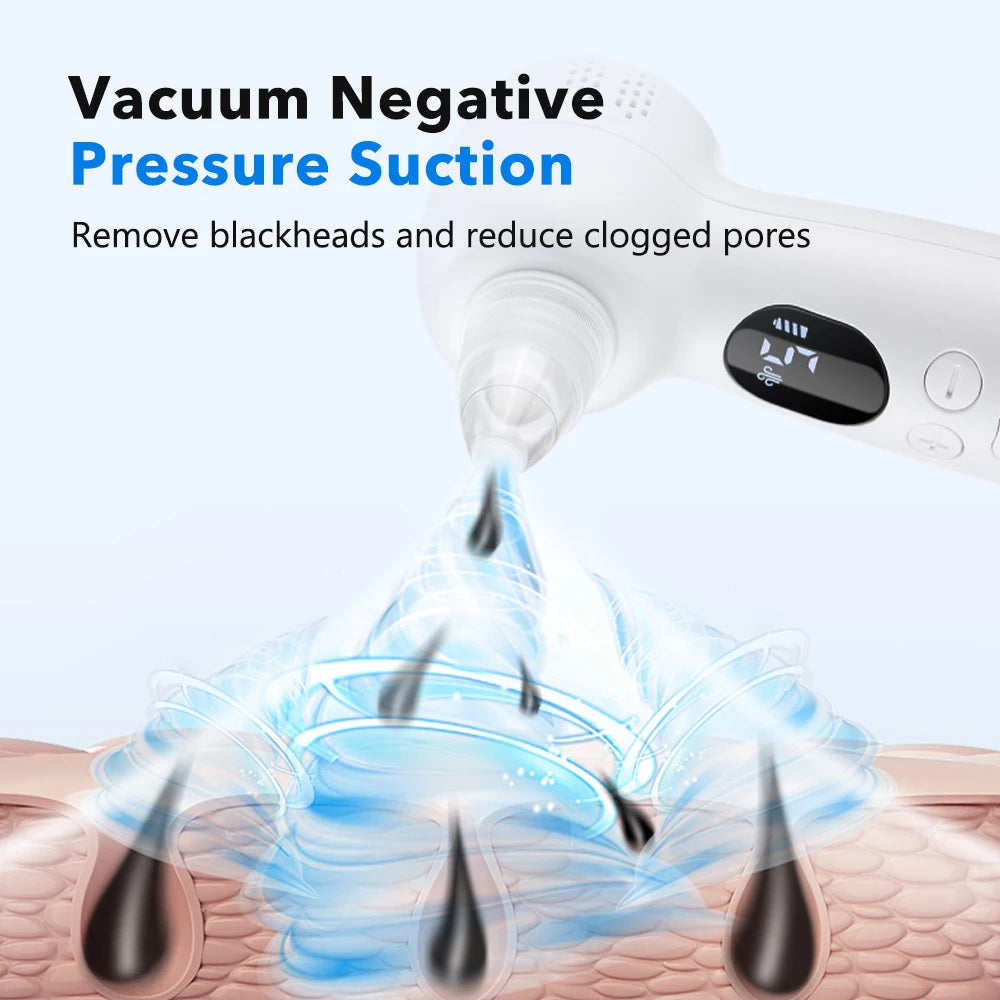 2-in-1 Smart Blackhead Remover Vacuum & Facial Pore Cleanser – Deep Pore Suction Device with 3-Level Heating Hot Compress