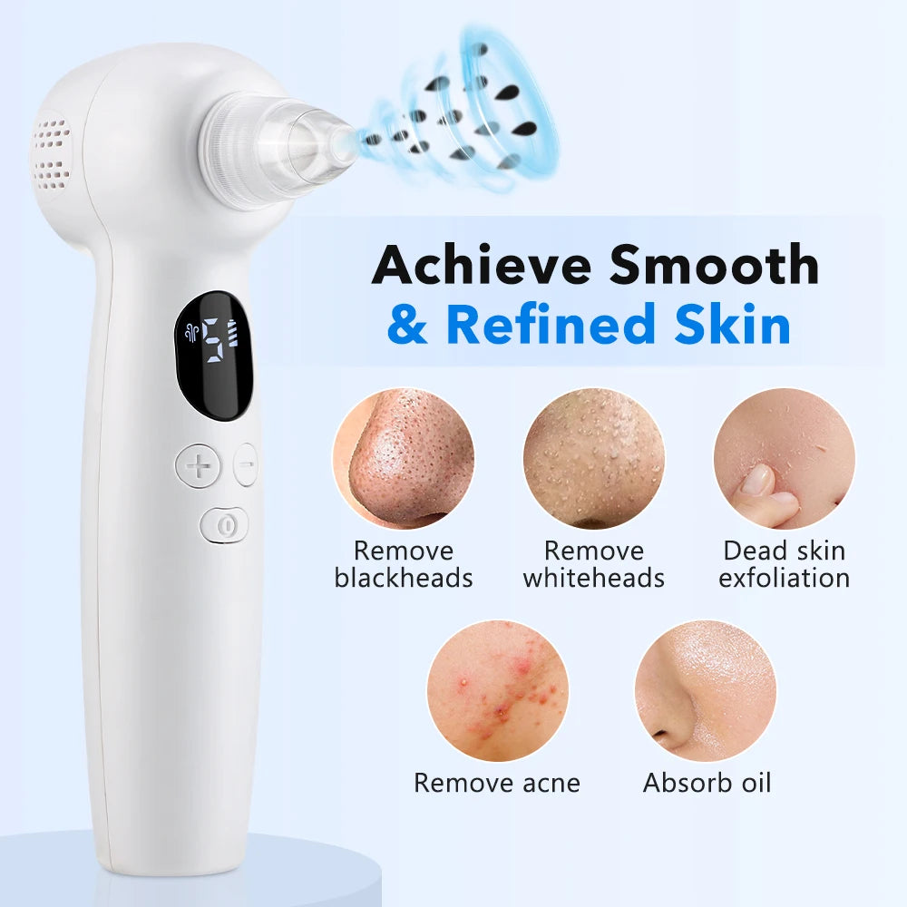 2-in-1 Smart Blackhead Remover Vacuum & Facial Pore Cleanser – Deep Pore Suction Device with 3-Level Heating Hot Compress