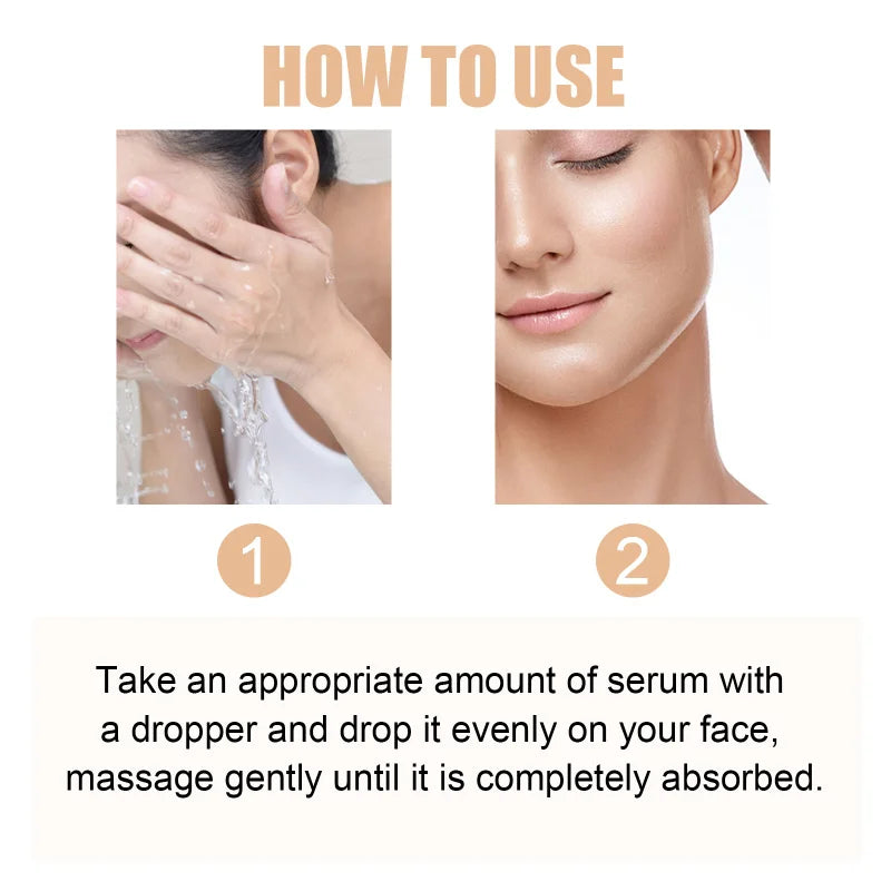 Hoygi Lactic Acid 10% + HA Serum – Exfoliating & Hydrating Face Peel (30ml)